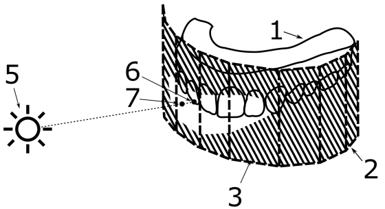 Rendering of dental models